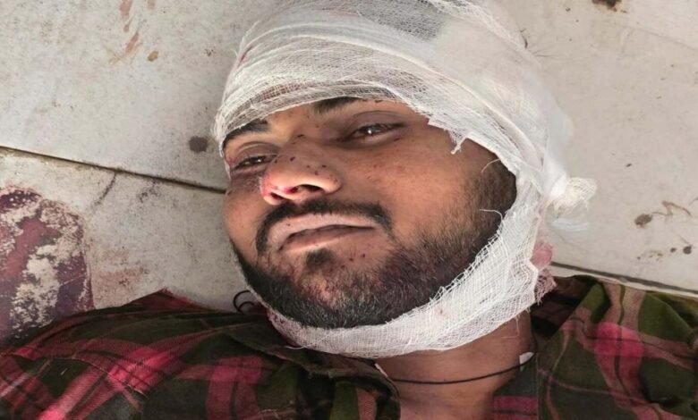 अपराधी अपराध छोड़ दें! UP पुलिस ने इनामी बदमाश का किया एनकाउंटर, क्रिमिनल पर दर्ज थे 50 से अधिक केस