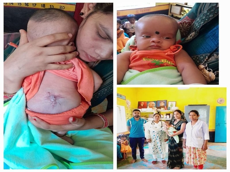 सर्जरी के बाद नन्ही सिद्धि पूरी तरह स्वस्थ, आयुष्मान योजना बनी जीवन संवारने वाली संजीवनी