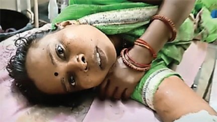 मोबाइल विवाद में बेटे ने माता-पिता को हंसिए से काटा
