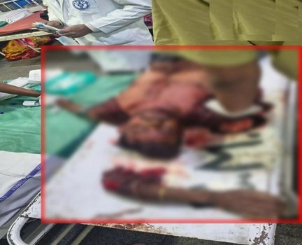 रेलवे स्टेशन पर दर्दनाक घटना, युवक का कटा हाथ देखकर दहले लोग