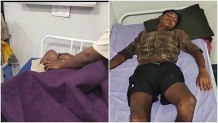 आकाशीय बिजली गिरने से 11 लोग प्रभावित