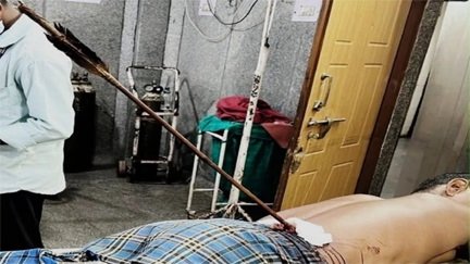 आंबेडकर अस्पताल में डॉक्टरों का जीवनरक्षक ऑपरेशन, तीर आर-पार, फिर भी बची जान