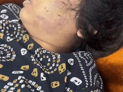अस्पताल में शव छोड़ भागा आरोपी, हत्या से सनसनी